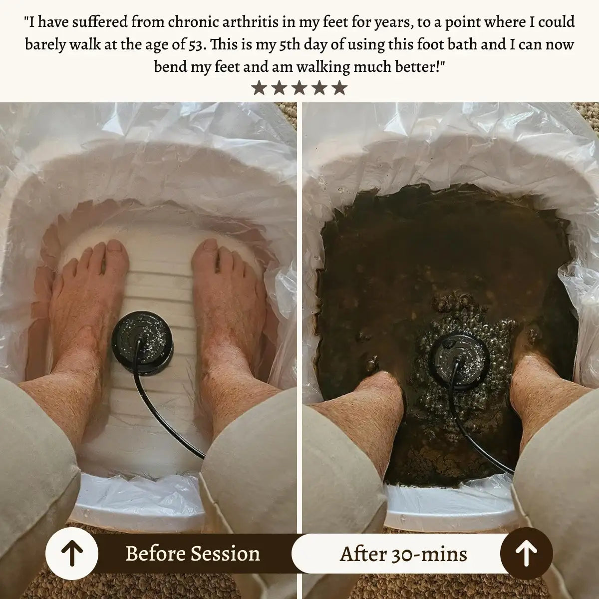 Pure Detox Ionic Foot Spa | Remove Toxins and Heavy Metals for a Healthier Life