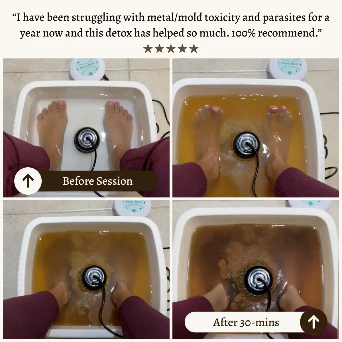 Pure Detox Ionic Foot Spa | Remove Toxins and Heavy Metals for a Healthier Life